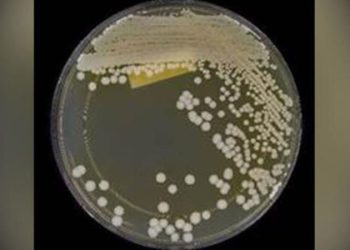 ABD alarmda: İlaca dirençli mantar hastalığı yayılıyor