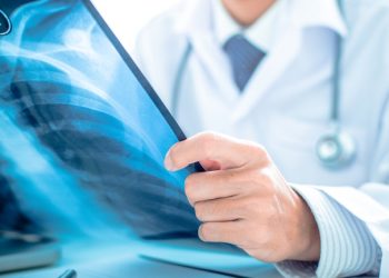 Akciğer Embolisi İyileşir Mi ?