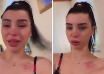 Aleyna Eroğlu’ndan Batuhan Karadeniz hakkında darp iddiası