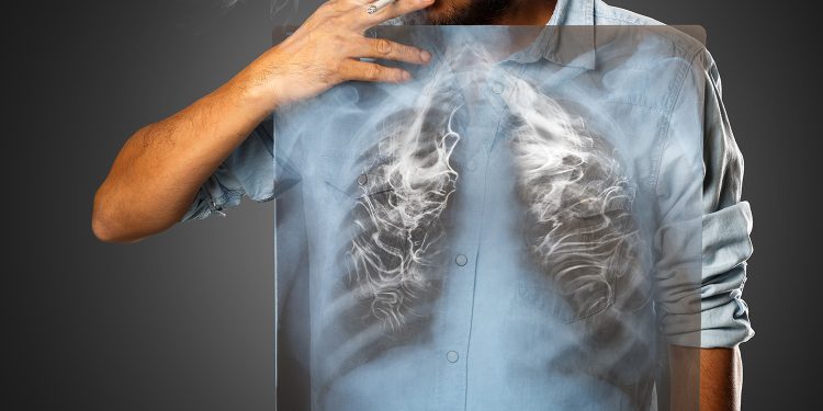 Bağımlılık Tedavisinde Kriz Yönetimi Öğretilmeli