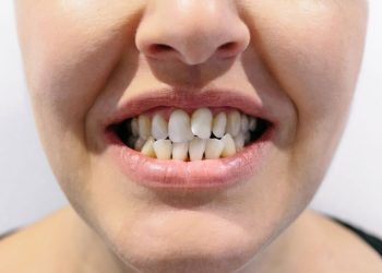 Diş Sağlığınızı Süt İçerek Koruyun