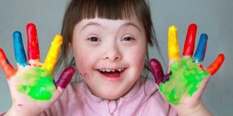 Dünya Down Sendromu Farkındalık Günü neden 21 Mart’ta kutlanıyor? Down sendromu nedir, belirtileri nelerdir?