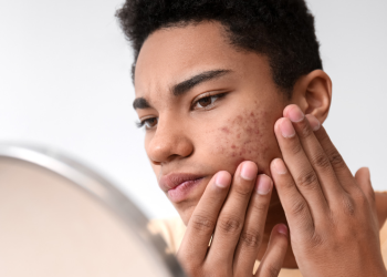 Geçmeyen Sivilceleriniz Varsa, Köpek Memesi Hastası Olabilirsiniz