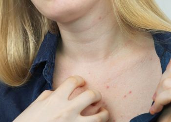 Pandemi Uyuz Hastalığını Arttırdı !