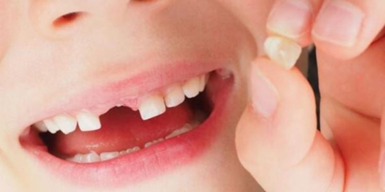Uzmanı uyardı: Çocuklarda çürüyen süt dişlerinin takibi yapılmalı