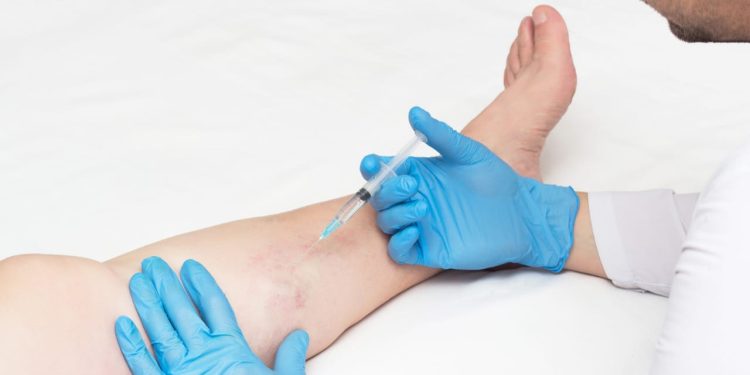 Varis Hastalığında Genetik Özellikler Riski Artırıyor