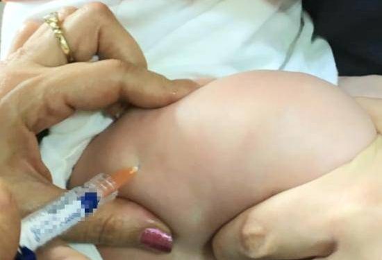 Kızamık Aşısı Nasıl Yapılmalı ?