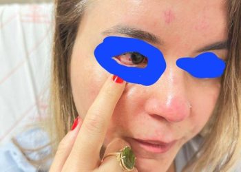 Doktor Saçlarından Sürüklenerek Darp Edildi !